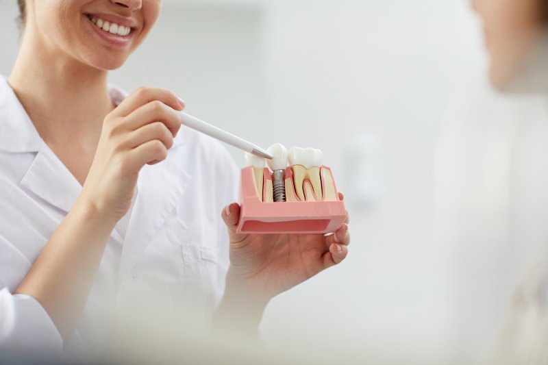 high quality porcelain veneers